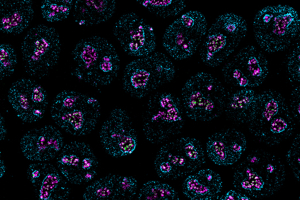 A microscope image of light blue dots that form the shape of cell nuclei. Pink dots and inside the nuclei represent bimolecular condensates.